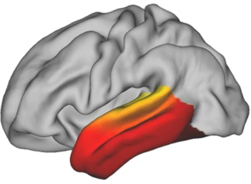 Temporal cortex connectivity gradient