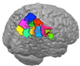 Lateral parietal